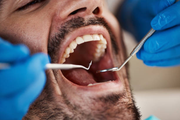 Best Emergency Dental Services for Seniors in Graham, WA