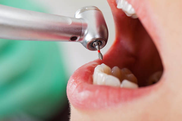 Best Broken or Cracked Tooth Emergency Dentist in Graham, WA